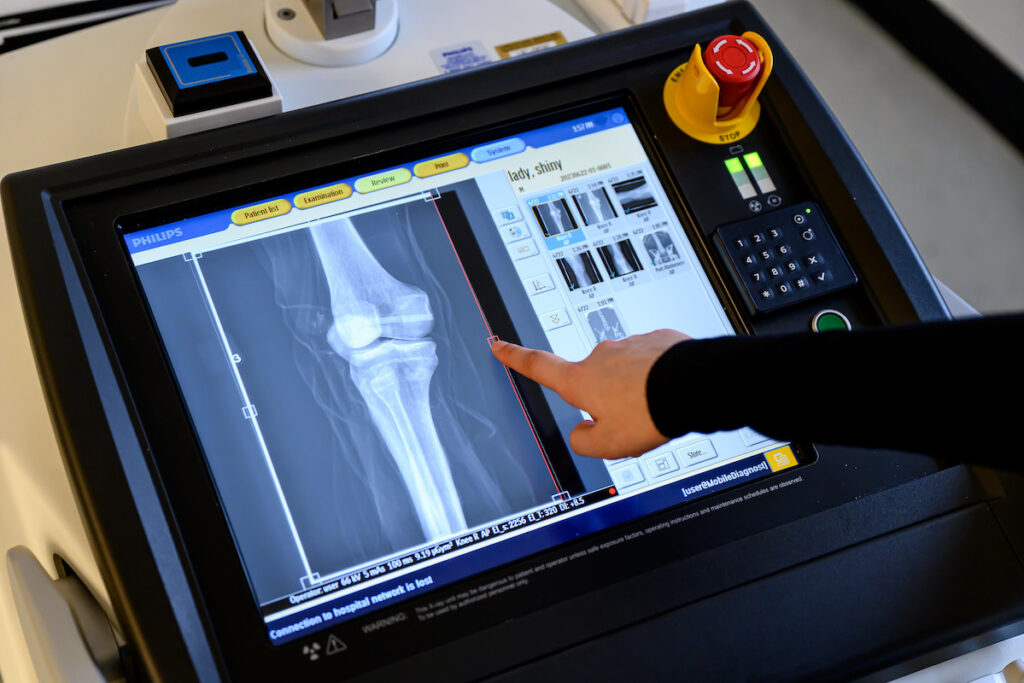 Radiologic technology student looking at the scans of a patient